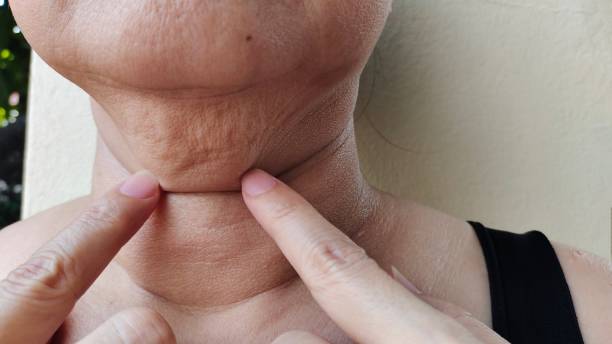 istock The Flabbiness and Flabby skin. 2184100489