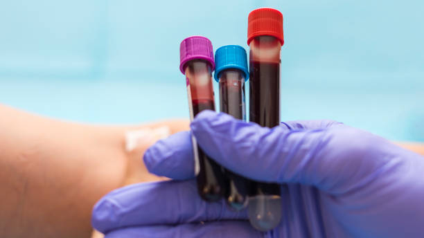 istock Blood test vials for blood groups held by nurse. Blood analysis concept, selective focus, copy space 2184121476