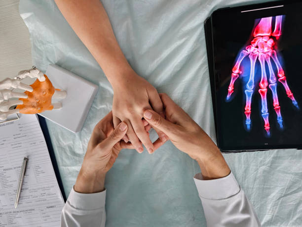 istock Doctor skeleton hand and patient with wrist pain 2184181813
