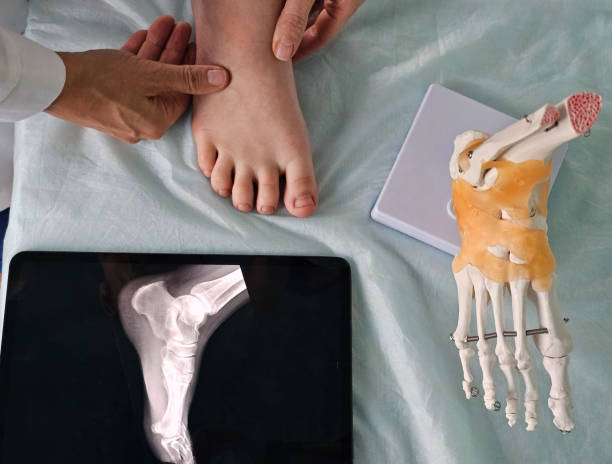 istock Doctor examines x-ray of patient legs 2184181816