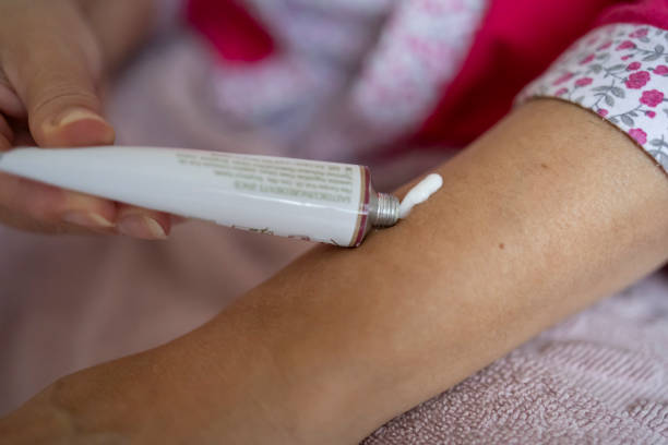A beautiful mature woman applies transdermal gel as hormonal therapy in menopause