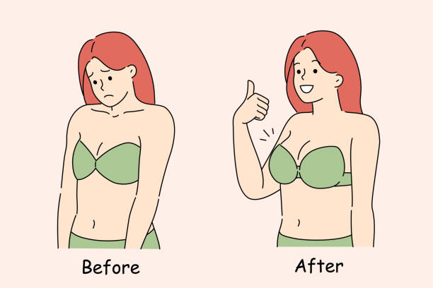 istock Woman who has had breasts enlarged through implantation and plastic surgery stands in bikini 2184392340