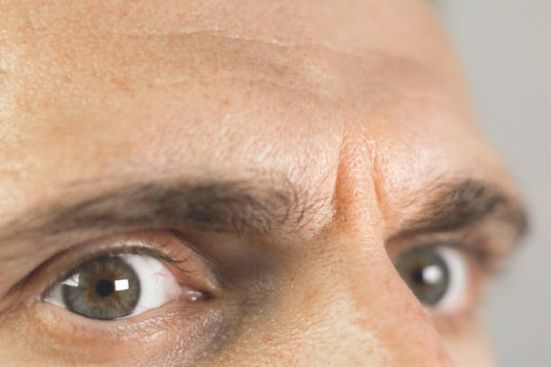 istock Frown lines between eyebrows on mans face. Vertical wrinkles, close up. 2184601564