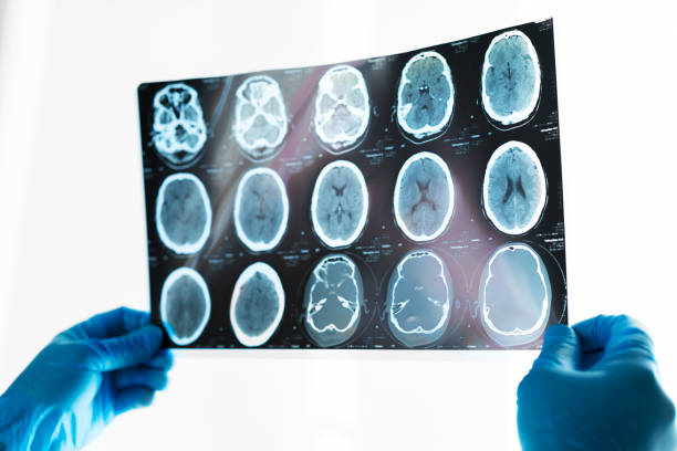 istock Hands of a doctor holding head mri scan 2184910740