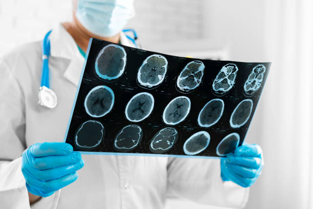 istock Hands of a doctor holding head scan 2184912900