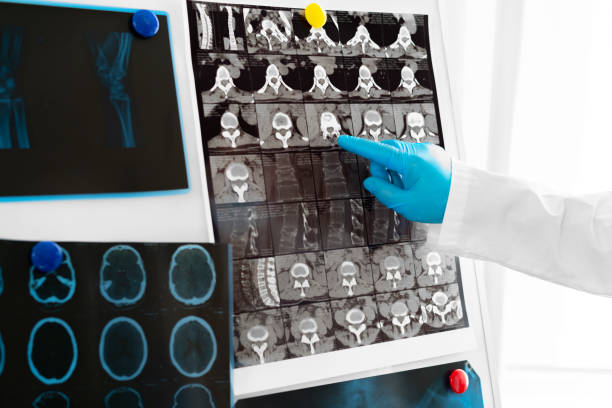 istock Hands of a doctor holding head mri scan 2184914031