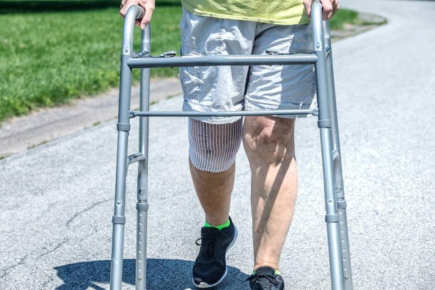 Knee Replacement Physical Therapy Patient Walking stock photo