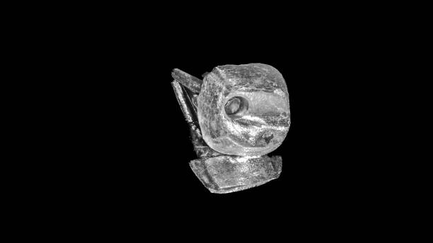 Metallic post and core build-up for molar infrastructure of crown and root reconstruction
