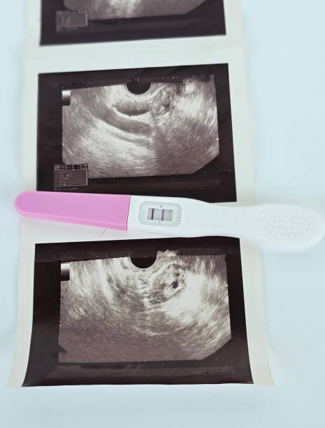 istock Ultrasound images and pregnancy test concept 2185863830