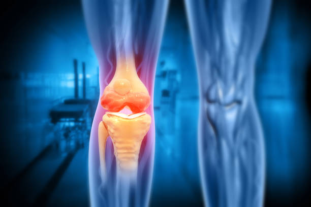 istock Pain in knee joint. Tendon problems and Joint inflammation on dark background. 3d illustration 2185914474