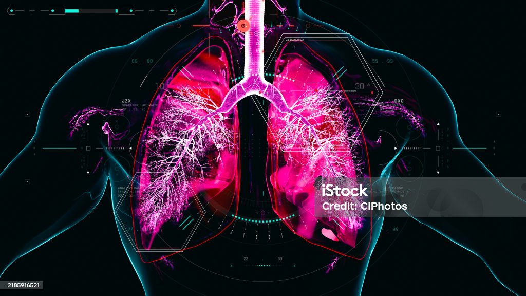 Copd Background Copd Lung Disease Chronic Obstructive Pulmonary Disorder Concept Stock ...