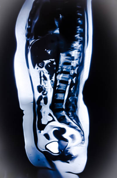 istock CT (computerized tomography) whole abdomen, urography, used to evaluate the urinary tract. 2185943939