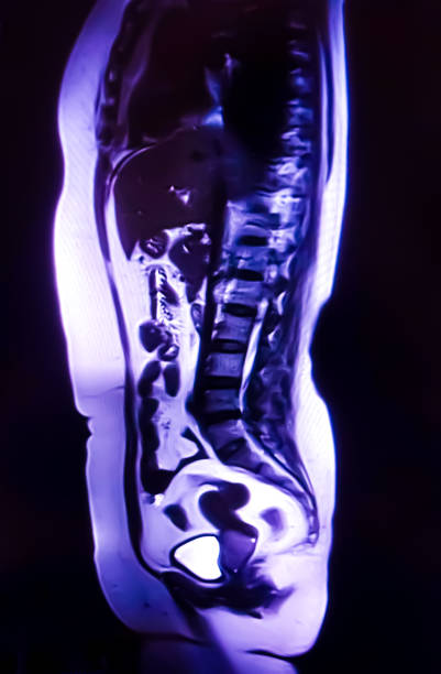 istock CT (computerized tomography) whole abdomen, urography, used to evaluate the urinary tract. 2185943963
