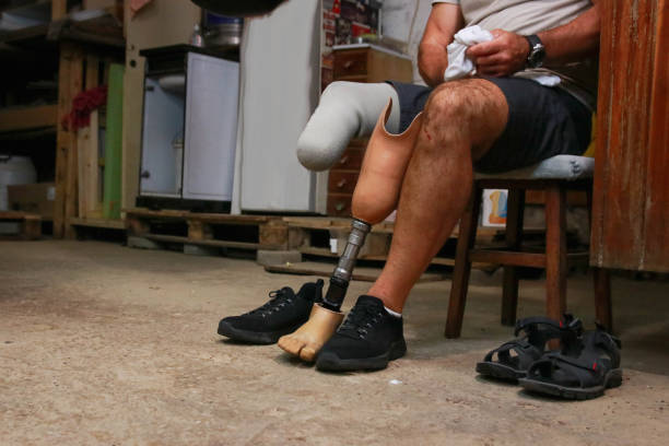 istock Senior man showing his artificial leg 2185989520