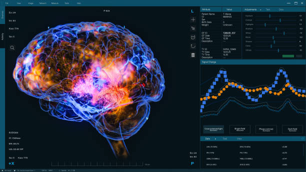 istock 3D VFX Animation of a Brain Scan in Medical Software, Visualization of Neural Activity and Data Visualization. Screen Replacement for Medical Hospitals and Software Engineers in Brain Research Science 2186165618