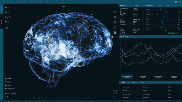 istock 3D VFX Animation of a Brain Scan in Medical Software, Visualization of Neural Activity and Data. Medical Research for Brain Mapping and Enhancing and Neuroscience Tech Experiment Software 2186193305