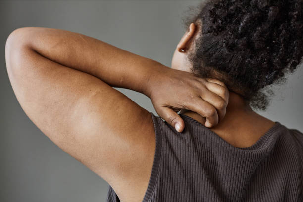 istock Black Woman Scratching Neck Closeup 2186297788