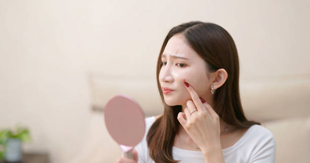 istock Asian woman unhappy with acne 2186649818