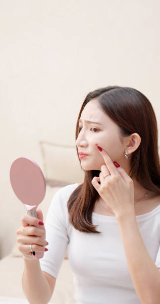 istock Asian woman unhappy with acne 2186649839