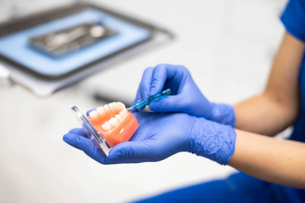 istock Close-up of dental model demonstration with a syringe. 2186662632