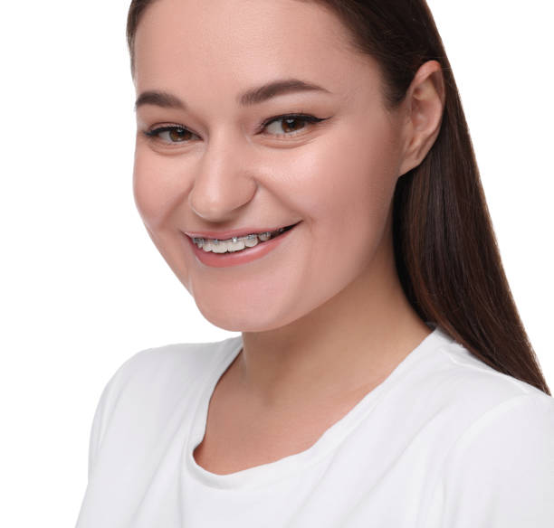 istock Smiling woman with dental braces on white background. Space for text 2186665003