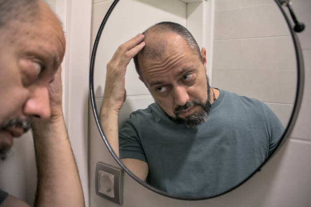istock Hair loss concept 2186677944