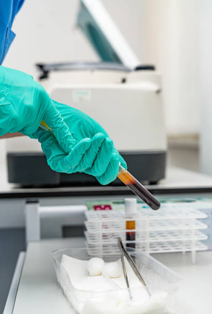 istock Testing blood samples in a lab. A technician in gloves prepares to analyze blood samples in a clinical laboratory using test tubes and equipment. 2186751878
