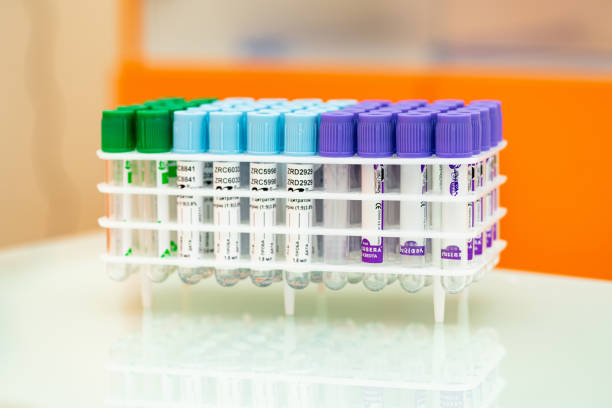 istock Test tubes arranged by color and function in a lab. Various test tubes in different colors are organized on a rack, ready for laboratory analysis in a medical facility. 2186754824