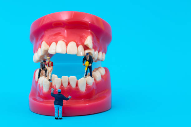 istock Miniature people orthodontist teeth model on blue background 2186986509