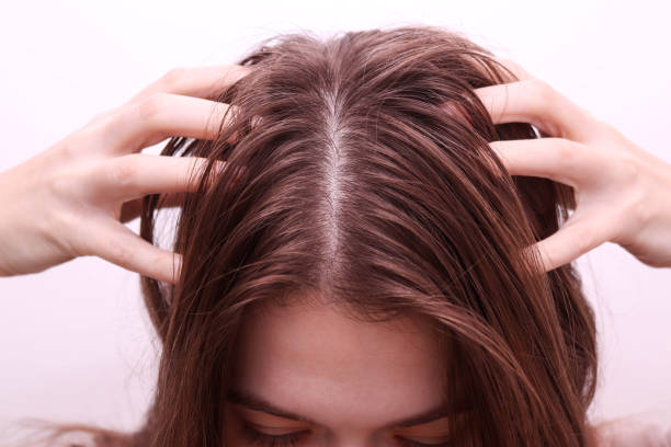istock Woman touching her dirty and greasy hair. Hair problem concept. 2187114371
