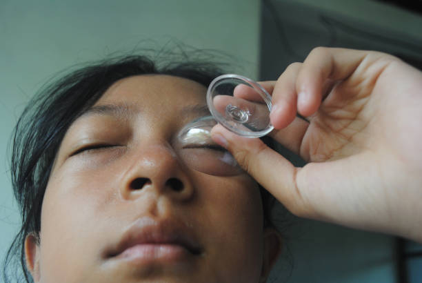 Boor water glass is a glass used for rinsing the eyes with Boor water (a weak antiseptic solution ) , a sterile eye wash and compress.