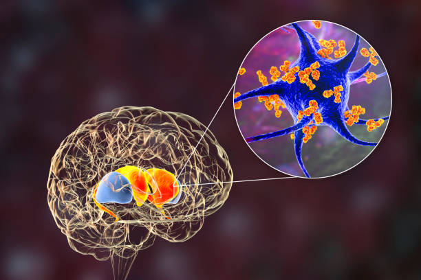 istock Anti-basal ganglia antibodies, artwork 2187420409