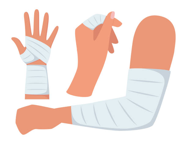 Bandaged arms and legs. Set of medical bandages elastic bandages. Elements of health care, first aid. Vector illustration. Bandaged arms and legs. Set of medical bandages elastic bandages. Elements of health care, first aid. Vector illustration bandage arm stock illustrations