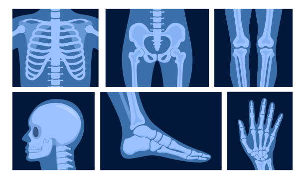 Different x-rays shot of human body part, set. Various x-ray pictures of head, hand, foot, leg, torso, chest and pelvis. Vector illustration. Different x-rays shot of human body part, set. Various x-ray pictures of head, hand, foot, leg, torso, chest and pelvis. Vector illustration x ray image stock illustrations