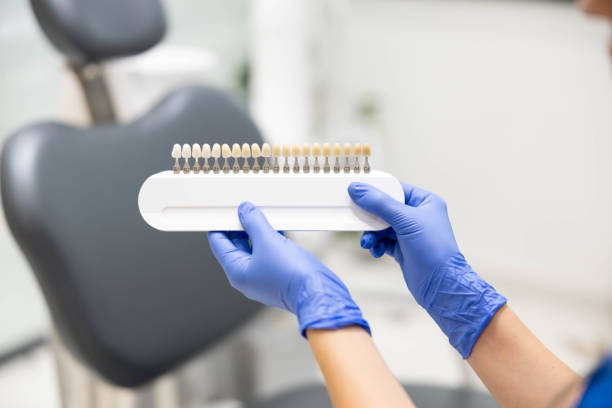 istock Dentist holding tooth shade guide in clinic 2187667154