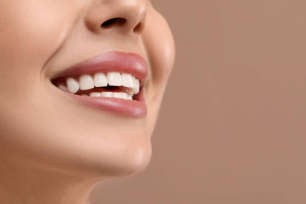 istock Woman with clean teeth smiling on beige background, closeup. Space for text 2187774120