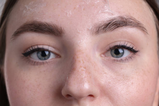 istock Woman with dry skin on face, macro view 2187774852