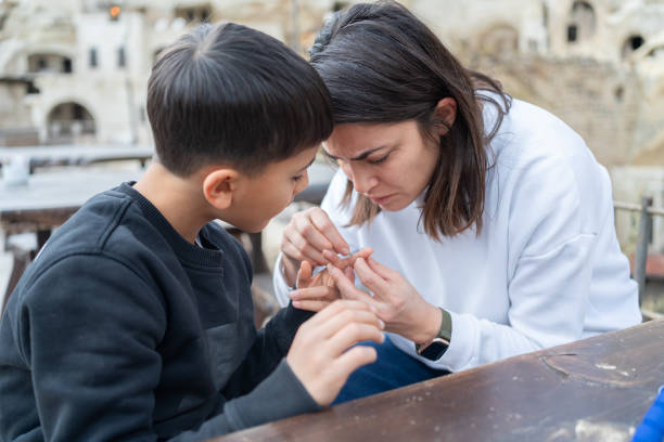 Woman Pulling Splinter Out Of Child's Hand With Tweezers Mother Trying To Pull The Splinter Out Of Son'S Hand With Tweezers sliver stock pictures, royalty-free photos & images