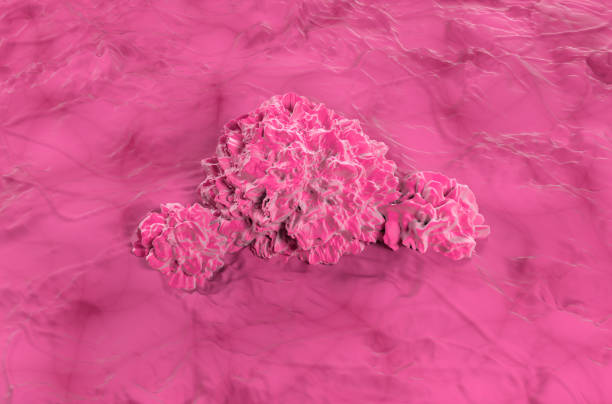 istock Bladder cancer - isometric view 3d illustration 2187964953