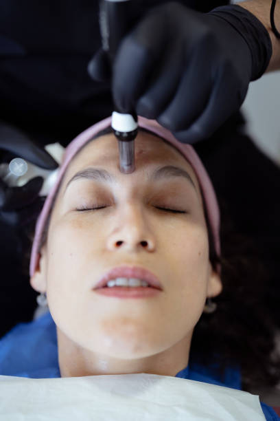 istock Beautician applying platelet-rich plasma treatment with dermapen on forehead 2188216052