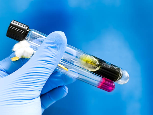 istock Physical examination by TSI agar and MIU agar in microbiology laboratory for bacterial detection showing Proteus Spp. lysine deaminase positive 2188225834