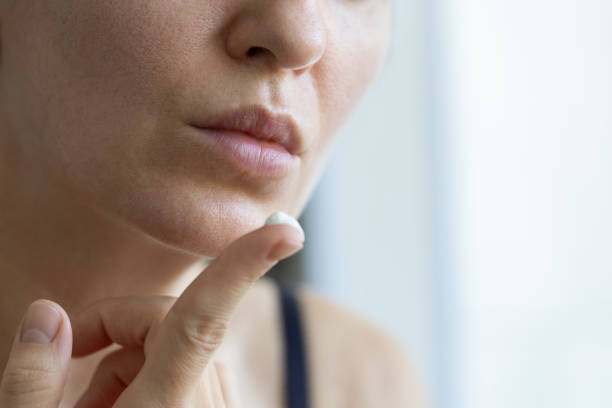 istock Woman with cream on her finger. Closeup, selective focus. 2188357466