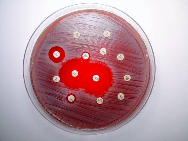 istock Only two drugs (Doxycycline and Linezolid) are sensitive in microbial susceptibility test of staphylococcus aurous. 2188862731