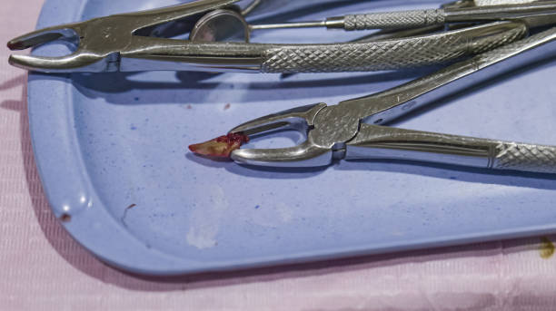 istock Equipment for tooth extraction at the dentist. 2189200635