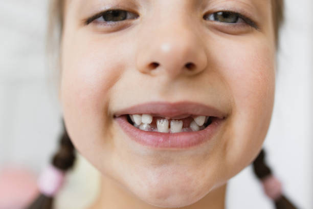 istock Close-up of smiling girl with missing teeth at home 2189209845