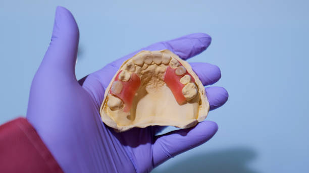 istock Dental Impression Mold Held by Gloved Hand in a Colorful Background 2189310285
