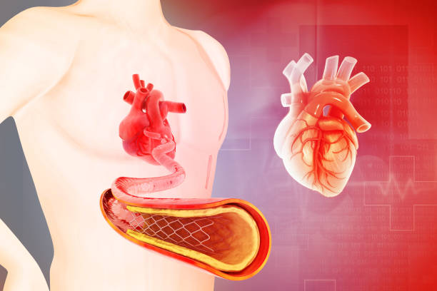 istock Stent angioplasty on scientific background. 3d illustration 2189543812