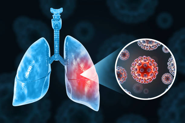 istock Chronic obstructive pulmonary disease, respiratory diseases, virus infection. 3d illustration 2189543942