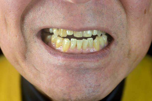 Close up of healthy old man teeth
