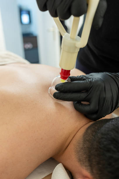 istock Therapist placing suction cup on patient's back during cupping therapy session 2189572372